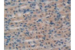 DAB staining on IHC-P; Samples: Rat Intestine Tissue (RNASE1 anticorps  (AA 26-152))