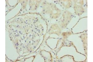 Immunohistochemistry of paraffin-embedded human kidney tissue using ABIN7176389 at dilution of 1:100