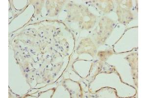 Immunohistochemistry of paraffin-embedded human kidney tissue using ABIN7176389 at dilution of 1:100 (ZNF563 anticorps  (AA 214-476))