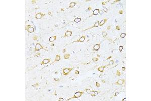 Immunohistochemistry of paraffin-embedded rat brain using HSPA5 antibody (ABIN5997936) at dilution of 1/100 (40x lens). (GRP78 anticorps)