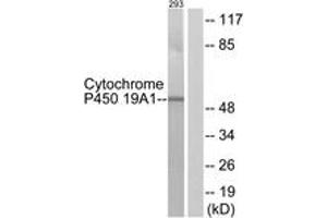 Western blot analysis of extracts from 293 cells, using Cytochrome P450 19A1 Antibody. (Aromatase anticorps  (AA 221-270))