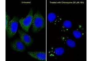 Fluorescent image of U251 cells stained with anti-ATG5 antibody diluted at 1:25 dilution.