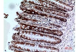 Immunohistochemistry (IHC) analysis of paraffin-embedded Human Colon, antibody was diluted at 1:100. (FOXP3 anticorps  (C-Term))