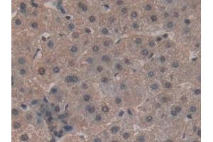 Detection of MYL2 in Human Liver Tissue using Polyclonal Antibody to Myosin Light Chain 2 (MYL2)