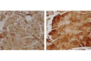 Immunohistochemistry analysis using Rabbit Anti-SOD2 Polyclonal Antibody .