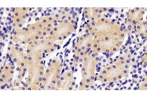 Detection of IFNa in Mouse Kidney Tissue using Polyclonal Antibody to Interferon Alpha (IFNa)