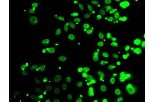 Immunofluorescence analysis of A549 cells using FIP1L1 antibody. (FIP1L1 anticorps)
