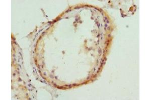Immunohistochemistry of paraffin-embedded human testis tissue using ABIN7155995 at dilution of 1:100