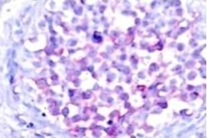Image no. 2 for anti-V-Raf-1 Murine Leukemia Viral Oncogene Homolog 1 (RAF1) (pSer259) antibody (ABIN318109) (RAF1 anticorps  (pSer259))