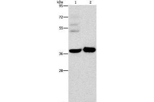 Western Blot analysis of A172 cell and Human fetal brain tissue using SERPINE2 Polyclonal Antibody at dilution of 1:450