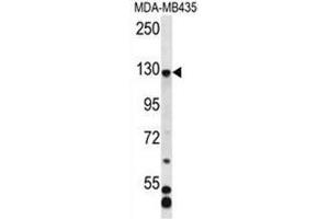 C7orf63 Antibody (N-term) western blot analysis in MDA-MB435 cell line lysates (35µg/lane). (C7orf63 anticorps  (N-Term))