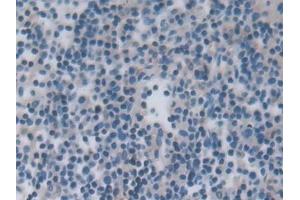 Detection of JNK1 in Rat Lymph node Tissue using Polyclonal Antibody to c-Jun N-terminal Kinase 1 (JNK1)