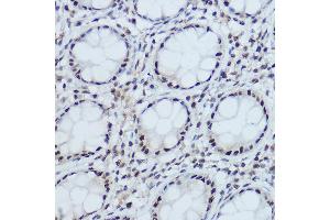 Immunohistochemistry of paraffin-embedded human colon using DDB1 Rabbit pAb (ABIN1679509, ABIN5664466, ABIN5664468 and ABIN6220382) at dilution of 1:350 (40x lens). (DDB1 anticorps  (C-Term))