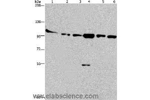 Western blot analysis of Human testis tissue, K562, A549, Raji, NIH/3T3 and Hela cell, using PRKD3 Polyclonal Antibody at dilution of 1:200 (PRKD3 anticorps)