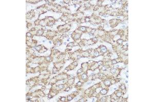 Immunohistochemistry of paraffin-embedded human liver using NDUF Rabbit pAb (ABIN7268802) at dilution of 1:350 (40x lens). (NDUFA4 anticorps  (AA 1-81))