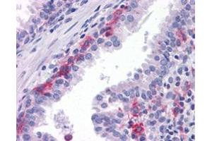 Immunohistochemical staining (Formalin-fixed paraffin-embedded sections) of human prostate with AXL monoclonal antibody, clone 7E10 .