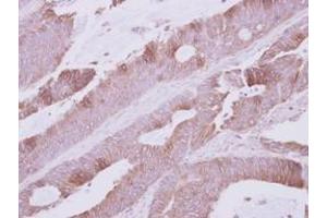 Image no. 1 for anti-Na Pump alpha Subunit (ATPALPHA) (Internal Region) antibody (ABIN1493677) (Atpalpha anticorps  (Internal Region))