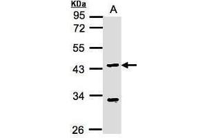 WB Image Sample(30 ug whole cell lysate) A:MOLT4 , 10% SDS PAGE antibody diluted at 1:1000 (KLF15 anticorps  (N-Term))