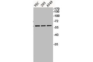 Western Blot analysis of VEC 293 A549 cells using BMP-5 Polyclonal Antibody