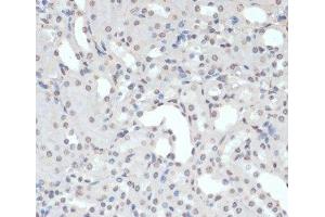 Immunohistochemistry of paraffin-embedded Mouse kidney using Phospho-Jak2(Y1007/1008) Polyclonal Antibody at dilution of 1:200 (40x lens). (JAK2 anticorps  (pTyr1007, pTyr1008))