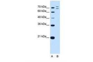 Image no. 2 for anti-Ring Finger Protein 168 (RNF168) (AA 401-450) antibody (ABIN6739167) (RNF168 anticorps  (AA 401-450))