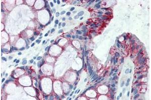 Human Colon (formalin-fixed, paraffin-embedded) stained with CLDN4 antibody ABIN334265 at 5 ug/ml followed by biotinylated anti-mouse IgG secondary antibody ABIN481714, alkaline phosphatase-streptavidin and chromogen.