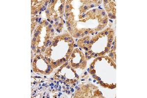 Immunohistochemical analysis of paraffin-embedded H. (CAPNL1 anticorps  (AA 1-420))