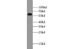 WB analysis of HEK293T cells subjected to SDS-PAGE, using RBM39 antibody (1/500 dilution). (RBM39 anticorps)