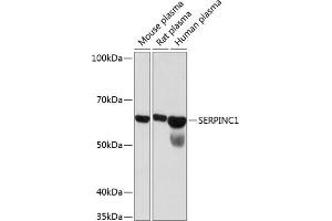 Western blot analysis of extracts of various cell lines, using SERPINC1 Rabbit mAb (ABIN7270208) at 1:1000 dilution.