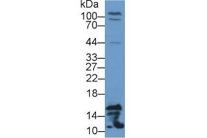Detection of FABP4 in Rat Testis lysate using Polyclonal Antibody to Fatty Acid Binding Protein 4 (FABP4) (FABP4 anticorps  (AA 2-132))