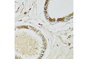 Immunohistochemistry of paraffin-embedded human breast using KLK10 Antibody (ABIN6142943) at dilution of 1:100 (40x lens). (Kallikrein 10 anticorps  (AA 35-276))