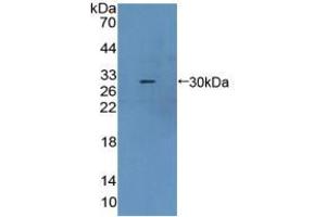 Western blot analysis of recombinant Mouse CBR1. (CBR1 anticorps  (AA 66-271))