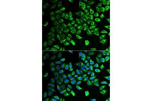 Immunofluorescence analysis of U2OS cells using DDAH2 antibody.