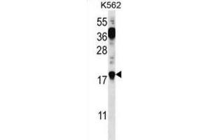 Western Blotting (WB) image for anti-Parathymosin (PTMS) antibody (ABIN2996966) (Parathymosin anticorps)