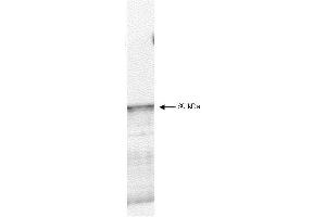 Western blot using  affinity purified anti-PDK-1 antibody shows detection of myc-tagged human PDK-1 at 60kDa in ~10 µg of a virus infected Sf9 cell lysate (arrow). (PDPK1 anticorps  (C-Term))