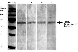 Western Blot analysis of Rat brain lysates showing detection of Synaptotagmin 7 protein using Mouse Anti-Synaptotagmin 7 Monoclonal Antibody, Clone S275-14 . (SYT7 anticorps  (AA 150-239) (Biotin))