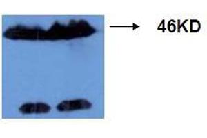 Western Blotting (WB) image for anti-Microtubule-Associated Protein tau (MAPT) (AA 177-187), (pThr181) antibody (ABIN1108155) (MAPT anticorps  (pThr181))