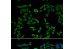 Immunofluorescence analysis of HeLa cells using VAPB Polyclonal Antibody (VAPB anticorps)