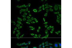 Immunofluorescence analysis of HeLa cells using VAPB Polyclonal Antibody (VAPB anticorps)