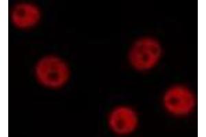 ABIN6276756 staining Hela by IF/ICC. (ERCC5 anticorps  (N-Term))