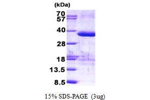 SDS-PAGE (SDS) image for Zinc Finger, AN1-Type Domain 1 (ZFAND1) (AA 1-268) protein (His tag) (ABIN5852954)