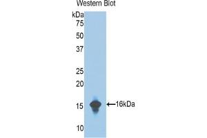 Western blot analysis of the recombinant protein. (Complement Factor B anticorps  (AA 476-592))