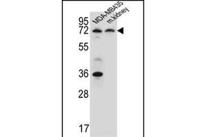 P2RX7 Antibody (C-term) (ABIN651861 and ABIN2840427) western blot analysis in MDA-M cell line and mouse kidney tissue lysates (15 μg/lane). (P2RX7 anticorps  (AA 563-592))