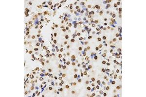Immunohistochemistry of paraffin-embedded mouse kidney using DiMethyl-Histone H3-K9 antibody.