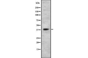 Western blot analysis GPR105 using HT29 whole cell lysates (P2RY14 anticorps  (Internal Region))