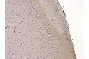 IHC analysis of SRCIN1 using anti-SRCIN1 antibody (ABIN6719623).