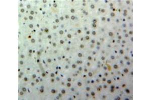 IHC-P analysis of Liver tissue, with DAB staining. (HNF1B anticorps  (AA 159-300))