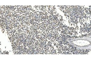 IHC analysis of NOX2/gp91phox/CYBB using anti-NOX2/gp91phox/CYBB antibody (ABIN7599875). (CYBB anticorps  (AA 124-559))