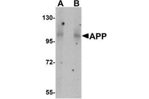 Western blot analysis of APP in mouse brain tissue lysate with AP30072PU-N APP antibody at (A) 1 and (B) 2 μg/ml. (APP anticorps  (N-Term))
