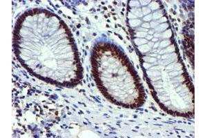 Image no. 3 for anti-Ubiquitin Specific Peptidase 7 (Herpes Virus-Associated) (USP7) antibody (ABIN1498592) (USP7 anticorps)